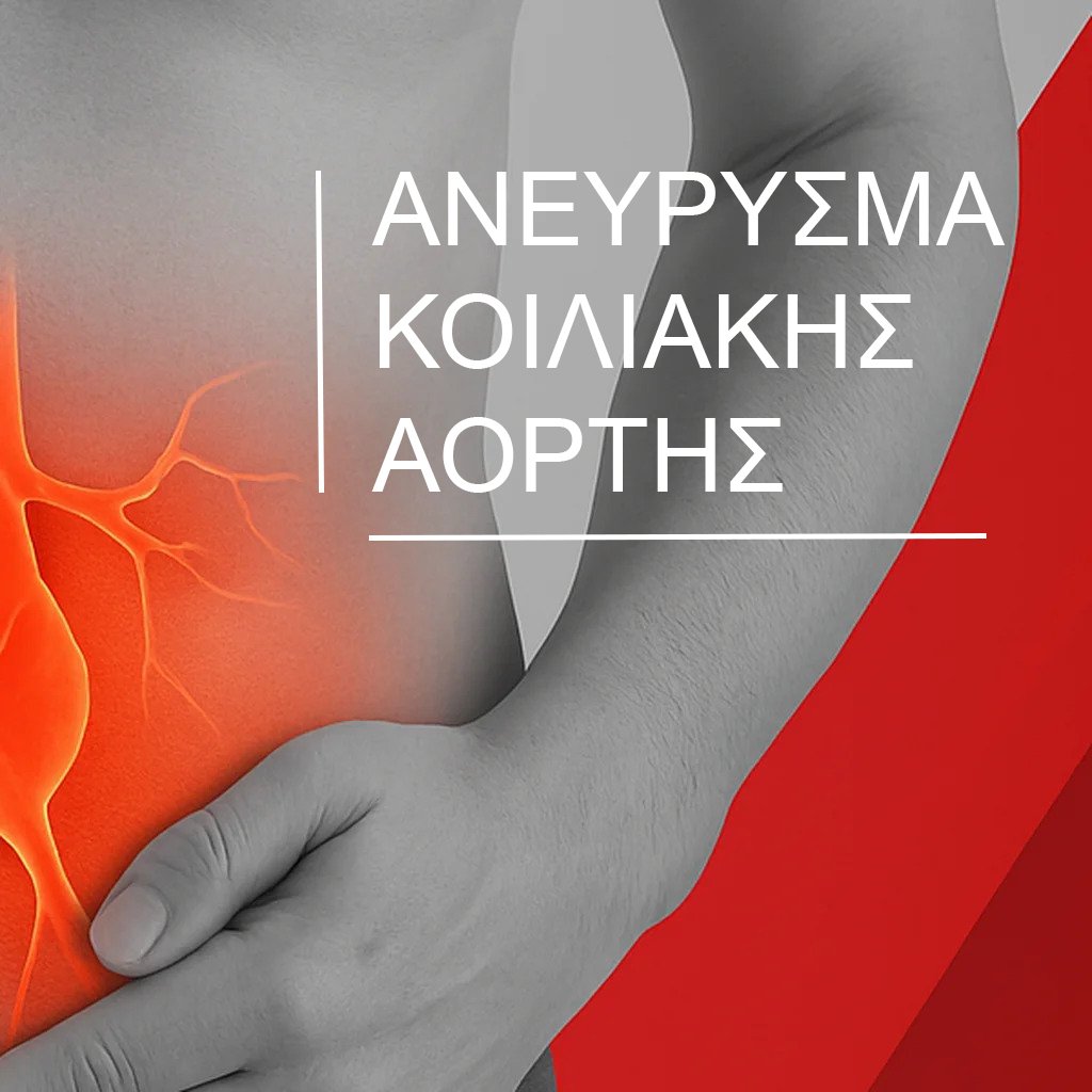 abdominal_aneurysm_1024x1024_final